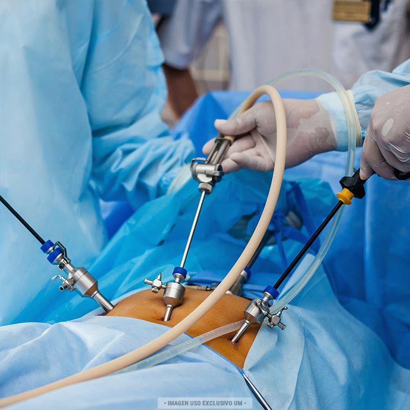 Paquete quirúrgico laparoscopia, cirugía laparoscopia
