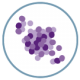 Staphylococcus aureus (SARM) Gram positiva